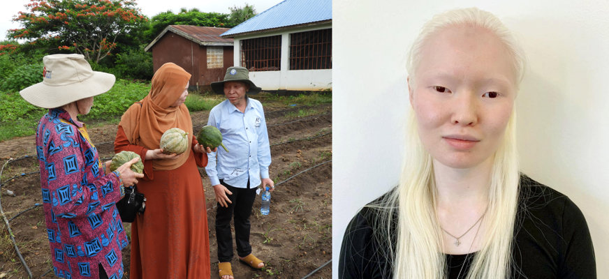 Till vänster: Tre tanzaniska personer med albinism står tillsammans i ett trädgårdsland i Tanzania. De håller i meloner som de odlat. Till höger: Porträtt på svensk kvinna med albinism. Kvinnan har långt ljust hår och asiatiskt påbrå.